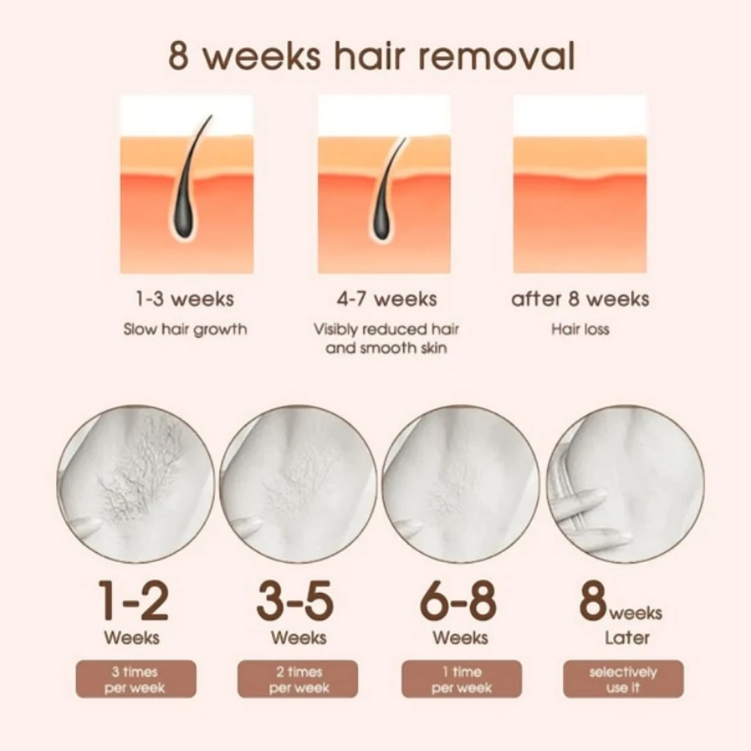 Laser Hair Removal Machine