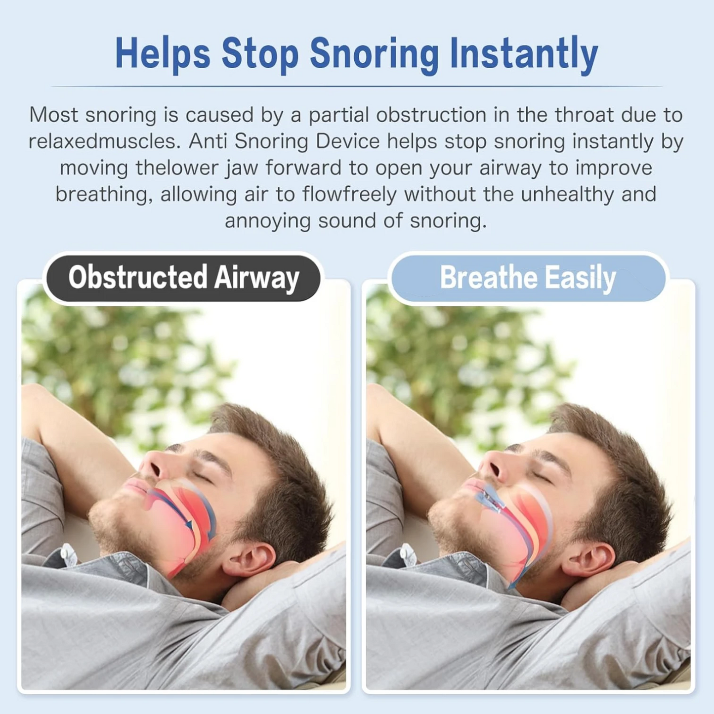 SuWeei Anti-Snore Mouth Guard – Adjustable