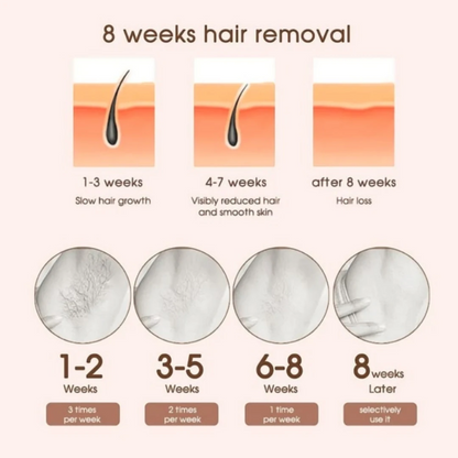 Laser Hair Removal Machine