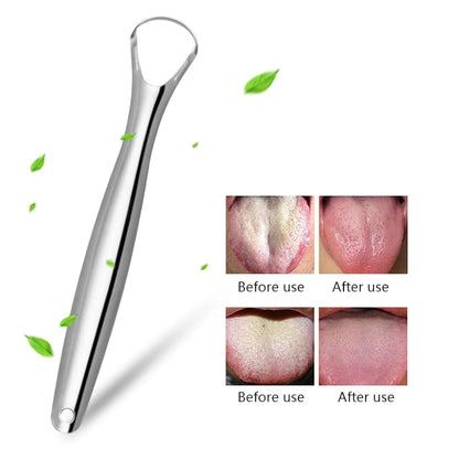 Stainless Steel Tongue Scraper – Oral Hygiene Tool